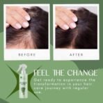 Bliss of Earth Rosemary Water Spray For Hair Growth 200ml, 100% Natural Steam Distilled Rosemary Water For Hair & Skin, Helps Reduce Hair fall, Strengthens Hair. - Fast UK Delivery - Image 7