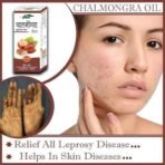 Fame Drugs Chalmogra Oil For Skin 60ML | Ayurvedic Chalmogra Oil 60 ML - Image 5