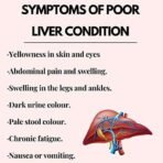 Vedic Roots Ayurvedic Biolive Liver Care Syrup|Alcoholic & Fatty Liver Detox Cleanser Medicine Tonic|Recover Liver Health Wellness,Liver Support Supplement - 500 ML - Fast UK Delivery - Image 5