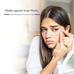 Blue Nectar Plum Face Serum for Acne Prone Skin and Acne Marks Oil Free Anti Acne Serum for Oily Skin Pore Minimizing Serum for Bumpy Texture Wi - Fast UK Delivery - Image 5