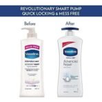 Vaseline Derma Care Advanced Repair Body Lotion|For Sensitive Dry Skin| Non Greasy|Long Lasting Moisturisation|400 ml - Fast UK Delivery - Image 6