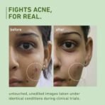 Plum Green Tea Pore Cleansing Face Wash for Oily, Acne Prone, Dry & Combination Skin | with Glycolic Acid | Fight Pimples & Control Excess Oil | Gentle Exfoliating & Non-Drying | Women & Men | 150ml - Fast UK Delivery - Image 4