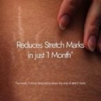 Kapiva Ghee Kumkumadi Stretch Mark Cream | Reduces Stretch Marks, Prevents Stretch Marks | 100% Natural | Suitable for All Skin Types | 200g - Image 3