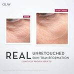 Olay Regenerist Micosculpting Serum | Hydrated, Plump, Bouncy Skin | With Hyaluronic Acid, Niacinamide and Peptides | Normal, Oily, Dry, Combination Skin | 50ml - Fast UK Delivery - Image 4