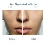 Blue Nectar Plant Based Kojic Acid Serum for Pigmentation & Dark Spots Removal | Anti-Pigmentation Face Serum for Women & Men with Rice Water & Mushroom (13 Herbs, 30ml) - Fast UK Delivery - Image 6