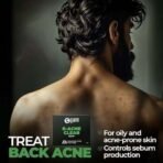 Beardo B- Acne Clear Soap for Men, 75g X 3 | With Tea Tree and Salicylic Acid | Clean Clear Skin | For Body Acne and Skin Purification | B-acne | For All Skin Types - Fast UK Delivery - Image 4