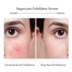Blue Nectar AHA Exfoliator for Face with Plant Based Glycolic Acid from Sugarcane for Deep Exfoliation | AHA Peeling Solution Exfoliating Face Serum for Blackheads & Tan Removal |10 Min Facial Exfoliation (14 Herbs,30ml) - Fast UK Delivery - Image 5