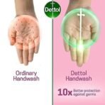 Dettol Detol In Lhw Skc 175X3-Prc Of - Fast UK Delivery - Image 5