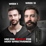 Beardo Beard Activator Derma Roller for Men, 540 - 0.5mm Chromium needles, Stimulates Hair Growth | Follicles activation | No Patchy Beard with Hair Growth Derma Roller - Fast UK Delivery - Image 7