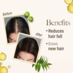 Kesh King Ayurvedic Oil for Hair Fall Control | Reduces Hairfall and Supports New Hair Growth | 21 Ayurvedic Herbs | 100ml - Fast UK Delivery - Image 6