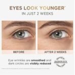 L'Oreal Paris Revitalift Hyaluronic Acid Eye Serum, 20ml, 1.5% Hyaluronic Acid and 1% Caffeine, Lightweight Texture, Non-Sticky, Reduce Fine Lines Under Eyes - Fast UK Delivery - Image 4