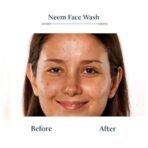 Blue Nectar Plant Based Vitamin C Face Wash for Women and Men Face Wash for Acne Pimple with Neem Honey Natural Cleanser for Face with Ayurved - Fast UK Delivery - Image 5