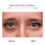 Blue Nectar Under Eye Serum with Plant Based Niacinamide from Potato Starch Papaya Dark Circles Serum with Advance Skin Firming Brightening Form (17 Herbs, 30ml) - Image 5