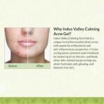 Indus Valley Calming Acne Gel 30ml - Fast UK Delivery - Image 5