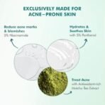 mCaffeine 10% Niacinamide & Panthenol, Vitamin B5 Oil-Free Moisturizer for Acne with Matcha Tea| Lightweight Hydration & Soothes Skin | Non-greasy, Fragrance-Free | For Oily, Acne Prone Skin - 50ml - Fast UK Delivery - Image 7