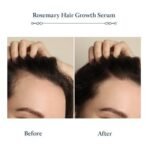 Blue Nectar Advanced Plant Based Rosemary Hair Growth Serum, Natural Alternate for Redensyl for Hair Growth | Intensive Ayurvedic Hair Serum for Women & Men for Healthy Hair & Scalp with Bhringraj (8 Herbs, 100 ml) - Fast UK Delivery - Image 5
