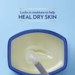 Vaseline Pack Of 3 : 100% Pure Petroleum Jelly, 1.75 Oz / 49 Gr Jars (Pack Of 3) - Fast UK Delivery - Image 6