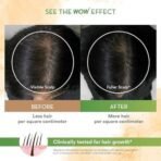 WOW Skin Science Rosemary Essential Oil | Strengthens Weak Hair | Restores Hair & Scalp Health, Adds Shine & Volume | 15ml - Fast UK Delivery - Image 7