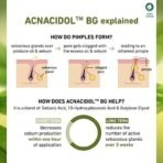 Plum Green Tea & Zinc Complex 3% | With AcnacidolTM BG & natural AHAs | Fights Pimples & Tightens Pores | Controls Oil & Gently Exfoliates - Fast UK Delivery - Image 5