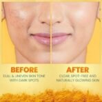 Himalaya Dark Spot Clearing Turmeric Kit (Pack of 3) | 100% Organically sourced Svarasa Turmeric | Free Jute Bag | Face Wash 100 ml | Face Pack 100 gm | Serum 30 ml | Power of Glycolic Acid & Niacinamide | Gives radiant spot free skin | Non-Staining - Fast UK Delivery - Image 7