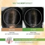 WOW Skin Science Rosemary with Biotin Hair Growth Oil | Stimulates New Hair Growth | Controls Hair Fall & Reduces Hair Breakage | Gives Healthy Hair - Fast UK Delivery - Image 5
