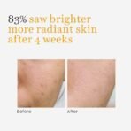 O3+ Vitamin C Face Serum Glow 30ml for Radiant Glowing Skin | Suitable for Combination Skin - Fast UK Delivery - Image 7