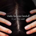 Kapiva Dandruff Control Neem Triphaladi Shampoo | Helps to reduce mild to heavy dandruff in 1 month - Fast UK Delivery - Image 4