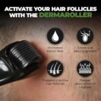 Beardo Rosemary Essential Oil, 15 ml & Derma Roller For Hair Growth 0.5 mm with 540 Chromium Needles | for Hair Growth, Hair fall and Regrowth | Skin Nourishment | 100% Natural | Aroma Oil - Fast UK Delivery - Image 4