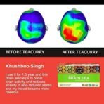 TEACURRY Brain Turmeric Tea (1 Month Pack, 30 Tea Bags)-Helps With Improving Memory And Concentration Level,50 Grams - Fast UK Delivery - Image 6