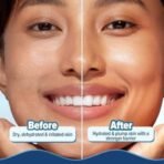 Aqualogica 5 Barrier+ Hydra Gel Moisturizer with Avocado & 5 Essential Ceramides - 200 g (Pack of 2) - Fast UK Delivery - Image 5