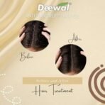DEEWAL Ayurvedic Anti-Dandruff Hair Oil - Natural Solution for Dandruff-Free Hair | Nourishing & Soothing Formula | 100% Natural Ingredients | 100ml - Fast UK Delivery - Image 6