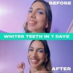 Closeup White Now Stain Eraser toothpaste for Teeth Whitening | Removes 100% surface stains to whiten teeth| Minty Fresh | Enamel safe & for daily use 100g - Fast UK Delivery - Image 5