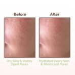 Mamaearth Rice Water Dewy Face Toner with Rice Water & 4% Niacinamide for Glass Skin 150ml |Intensely Hydrates |Minimizes Pores |Even Skin Tone |Korean Rice Toner | Alcohol-Free| Suits All Skin Types - Fast UK Delivery - Image 5