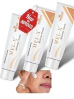 KRIG's Wheezal Mel X Melasma Cream - Set Of 3 Cream - Fast UK Delivery - Image 2