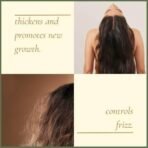 Agnaya Hair & Scalp Oil with Rosemary Bhringraj Kalonji | Controls Hair Fall | Combats Dandruff | Promotes New Hair Growth | Manages Frizz - Fast UK Delivery - Image 4