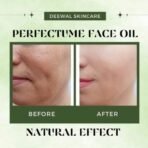 Deewal Tea Tree Oil for Acne & Blemish-Free Skin | 100% Pure & Organic Face Oil | Natural Skin Purifier | Reduces Dark Spots & Signs of Aging | Ideal for Clear, Healthy Skin | For All Skin Types - Fast UK Delivery - Image 6