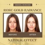 Deewal Rose Gold Radiance Face Oil | Organic & Pure Rose Oil for Glowing Skin | Reduces Dark Spots | All-Season Nourishment for Healthy Skin | All Skin Types - 30ml - Fast UK Delivery - Image 7