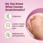 EQUALSTWO Anti Stretch Mark Oil, 200ml, 100% Natural Stretch Marks Removal Oil for Pregnancy, Enriched with Flex Seeds & Oat Oil to Lighten Scars, Dermatologically Tested, No Paraben No Sulphate (Pack of 2) - Fast UK Delivery - Image 5