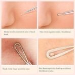 Bonjour Paris Sharp Tip Blackhead Remover, 100 Gm - Fast UK Delivery - Image 5
