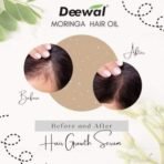Deewal Moringa Hair Oil | 100% Natural | Deep Moisturizer for Ultra Shiny & Smooth Hair | Promotes Hair Growth | Reduces Hair Breakage, Dandruff & Dry Scalp | Herbal Hair Care Solution - Fast UK Delivery - Image 6
