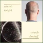 Agnaya Hair & Scalp Oil with Rosemary Bhringraj Kalonji | Controls Hair Fall | Combats Dandruff | Promotes New Hair Growth | Manages Frizz - Fast UK Delivery - Image 3