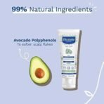 Mustela Baby Cradle Cap Cream 40ml - Newborn Safe - with Natural Avocado - Paraben Free & Fragrance Free - Fast UK Delivery - Image 5