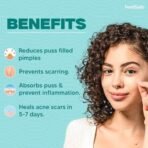 Femisafe Acne Pimple Patch: 72 Invisible, Waterproof Hydrocolloid Patches with 2% Salicylic Acid for Overnight Pus Reduction - Effective Spot Treatment for Active Surface Acne for Men & Women - Fast UK Delivery - Image 3