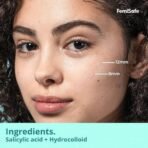 Femisafe Acne Pimple Patch: 72 Invisible, Waterproof Hydrocolloid Patches with 2% Salicylic Acid for Overnight Pus Reduction - Effective Spot Treatment for Active Surface Acne for Men & Women - Fast UK Delivery - Image 7