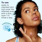 Clean & Clear Persa-Gel 10 Maximum Strength 1 oz (28 g) - Fast UK Delivery - Image 6