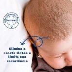 Mustela Stelaker/Cradle Cap Cream - 40ml/1.3oz - Gentle Solution for Cradle Cap - Fast UK Delivery - Image 4