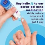 Clean & Clear Persa-Gel 10 Acne Medication Spot Treatment with Maximum Strength 10% Benzoyl Peroxide, Pimple Cream & Acne Gel Medicine for Face Acne with Benzoyl Peroxide Medication, 1 oz (pack of 4) - Fast UK Delivery - Image 4