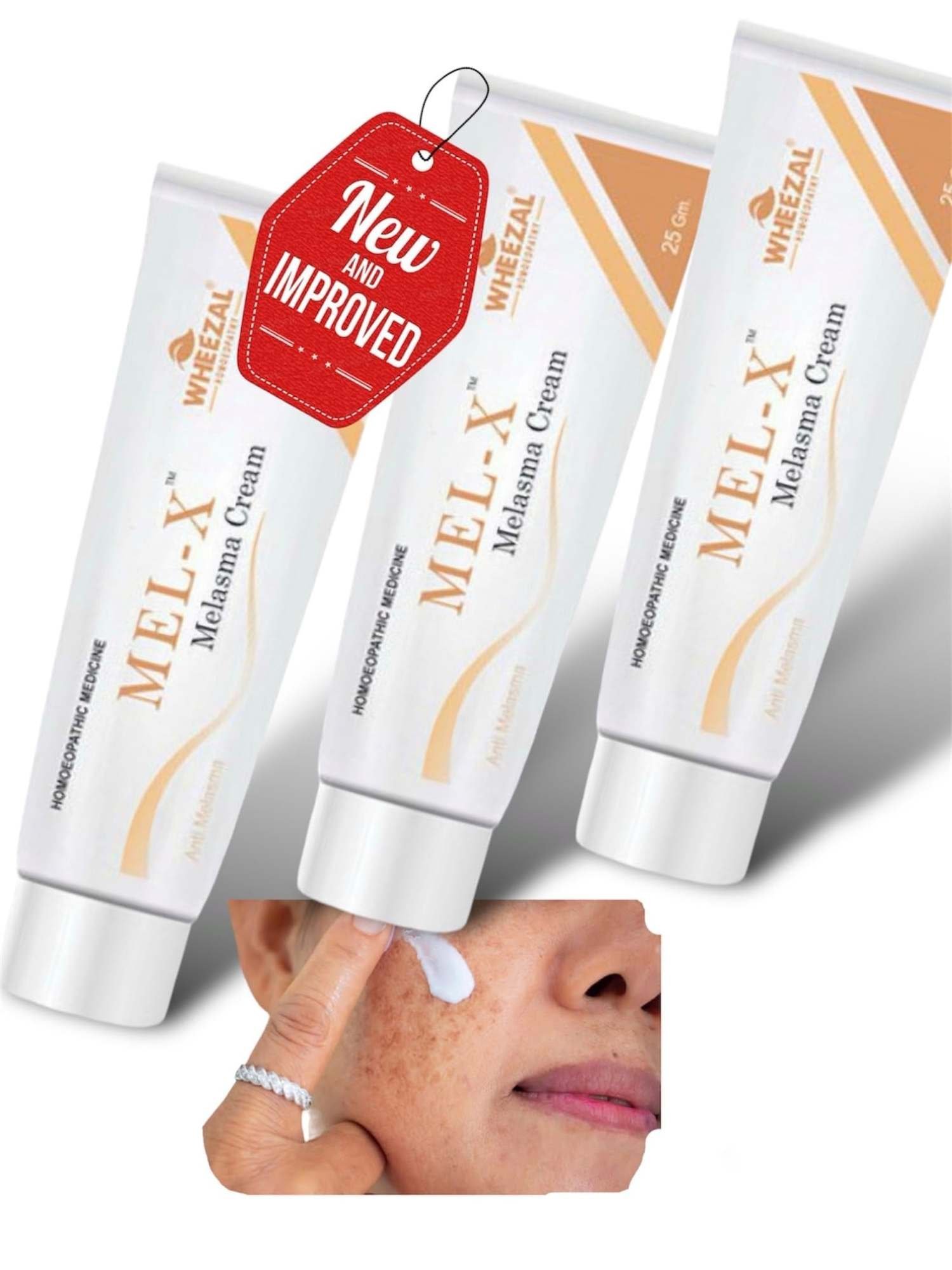 uk71AMXALmYL-1.jpg KRIG's Wheezal Mel X Melasma Cream - Set Of 3 Cream - Fast UK Delivery - Image 1
